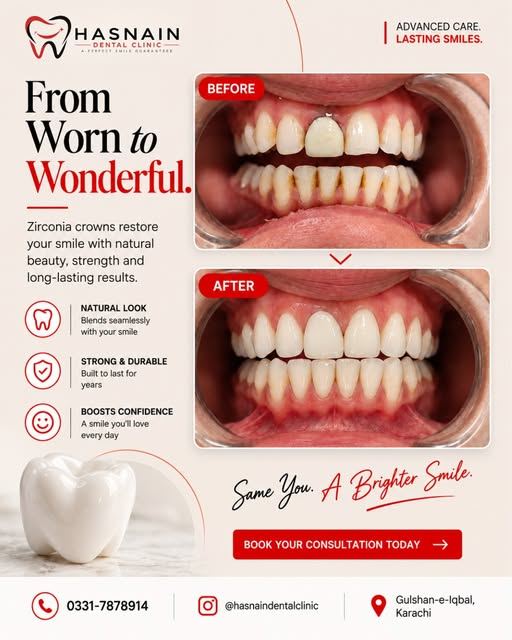 Hasnain Dental Clinic social post
